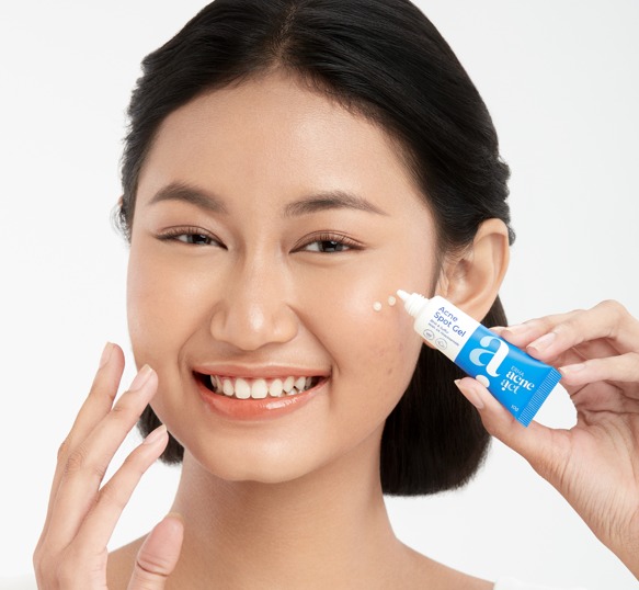 Acne Spot Gel, Si Kecil-Kecil Cabe Rawit yang Ampuh Atasi Jerawat dalam 24 Jam!