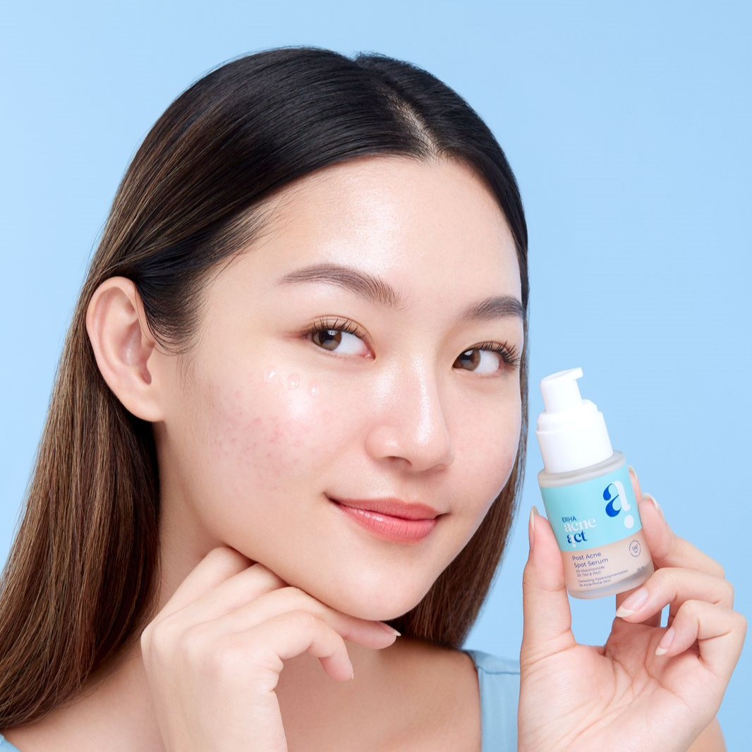 Serum Ini Bisa Hilangkan Jerawat Kamu dalam 7 Hari? Yuk, Cobain ERHA Acneact Post Acne Serum Sekarang!